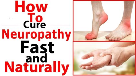 About half of people with diabetes have some form of neuropathy. . How i cured my neuropathy
